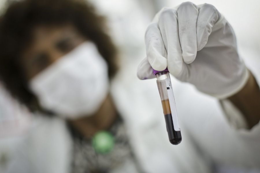 A leucemia é um tipo de câncer nas células sanguíneas produzidas pela medula óssea, e pode atingir crianças e adultos | Foto: Breno Esaki/Agência Saúde-DF